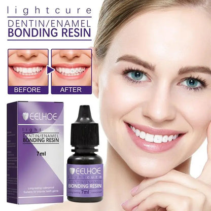 Light-Cure Dentin/Enamel Bonding Resin for Tooth Gems - 4 -  fh | ONEFY.SHOP