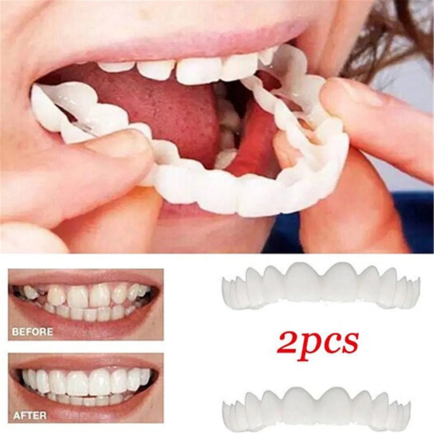 Temporary Top & Bottom Veneer Smile Set - 4 -  fh | ONEFY.SHOP
